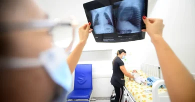 Aumento de 25% nos casos de SRAG no DF; SES-DF alerta para doenças respiratórias