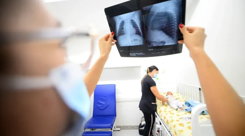 Aumento de 25% nos casos de SRAG no DF; SES-DF alerta para doenças respiratórias