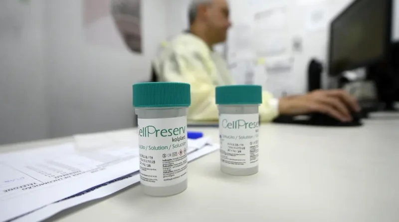 DF implanta teste de DNA-HPV na rede pública para rastreamento do câncer do colo do útero
