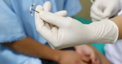 Quase 7 mil receberam Implanon; rede pública do DF mantém oferta de preservativos, DIU e cirurgias contraceptivas