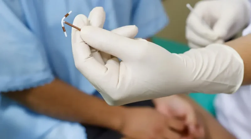 Quase 7 mil receberam Implanon; rede pública do DF mantém oferta de preservativos, DIU e cirurgias contraceptivas