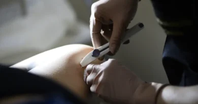 Implanon nas UBSs do DF: 12 mil unidades disponíveis para aplicação gratuita Mais 12 mil unidades do Implanon chegam às UBSs e ampliam oferta no DF
